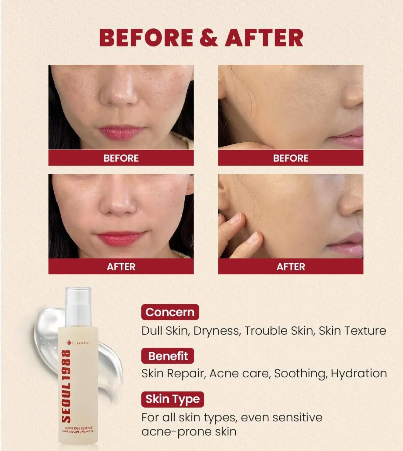 🐌SEOUL 1988 ESSENCE : SNAIL MUCIN 97% + RICE 100ML🐌