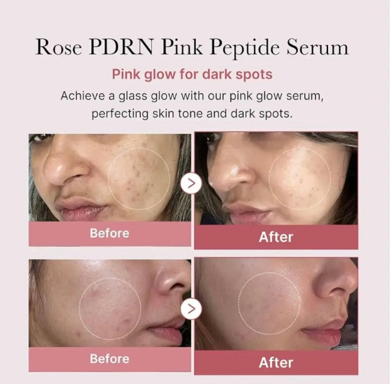 Medicube - PDRN Pink Peptide Serum, 30ml