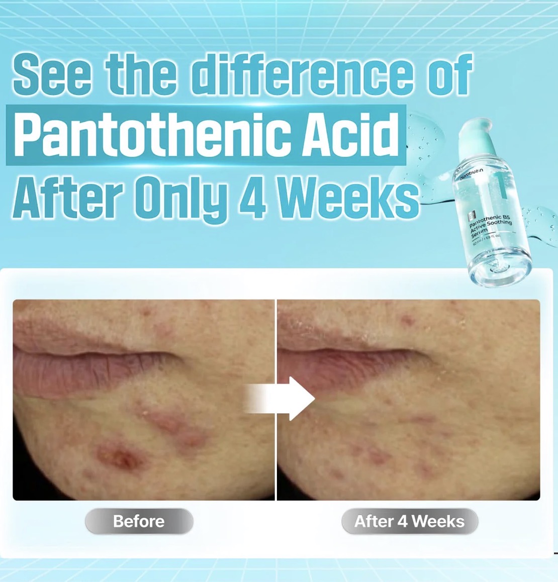 Numbuzin - No.1 Pantothenic B5 Active Soothing Serum - 50ml
