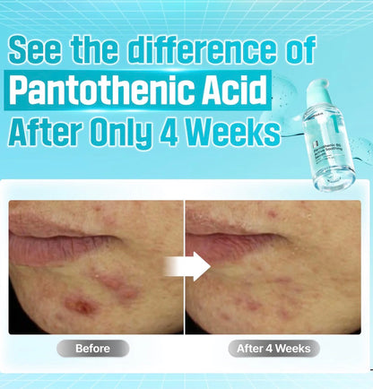 Numbuzin - No.1 Pantothenic B5 Active Soothing Serum - 50ml