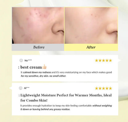 🎈[Dr Althea]345 Relief Cream 50ml